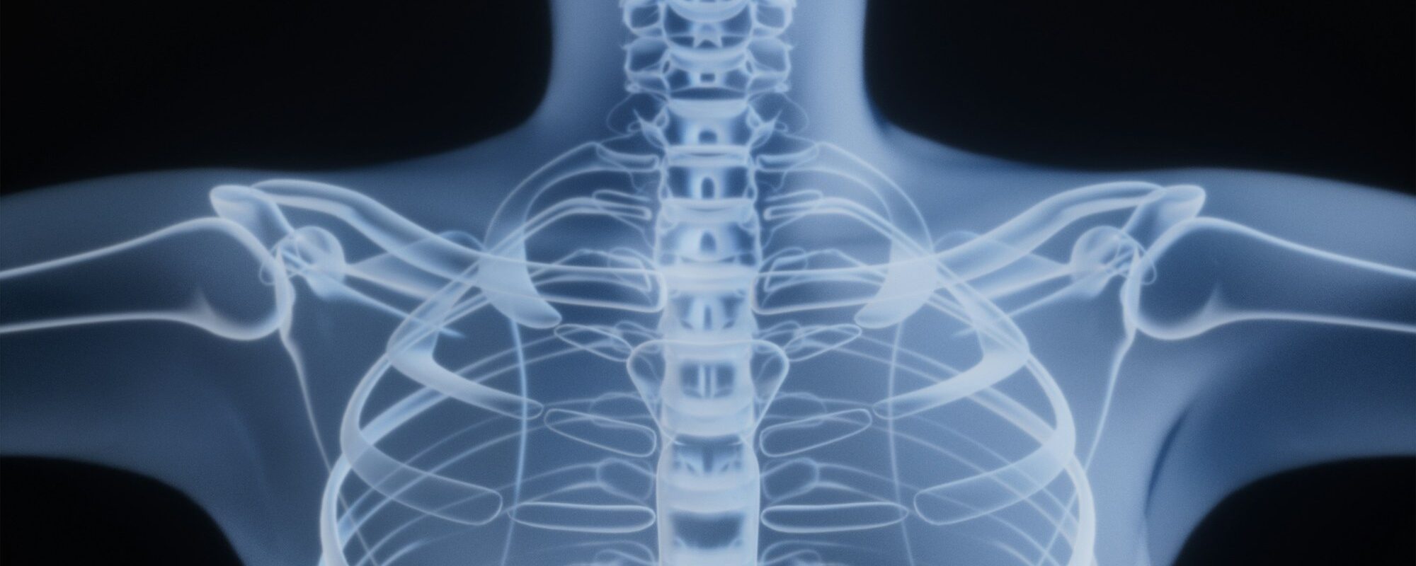Upper back by Rohit Choudhari