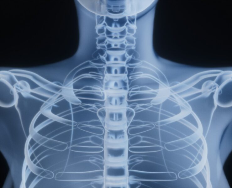 Upper back by Rohit Choudhari